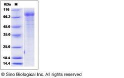 Sino Biological Rat CDH8 Protein 50ug (Sino Biological), Quantity: Each