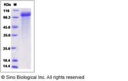 Sino Biological Rat CDH8 Protein 50ug (Sino Biological), Quantity: Each