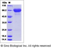 Sino Biological Rhesus TNFRSF4 Protein 50ug (Sino Biological), Quantity: