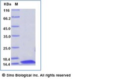 Sino Biological Der p 5 Protein 50ug (Sino Biological), Quantity: Each