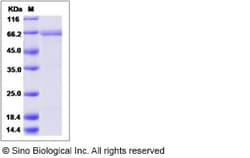 Sino Biological Rhesus EphB1 Protein 100ug (Sino Biological), Quantity: