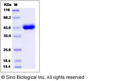 Sino Biological Rhesus REG1B Protein 100ug (Sino Biological), Quantity: