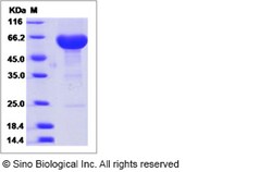 Sino Biological Cynomolgus IL20RB Protein 50ug (Sino Biological), Quantity: