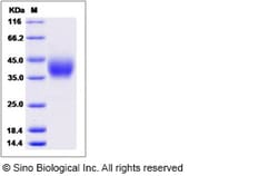 Sino Biological Rhesus PDCD1LG2 Protein 100ug (Sino Biological), Quantity: