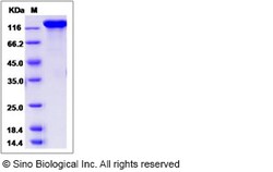 Sino Biological Rat CNTN3 Protein 100ug (Sino Biological), Quantity: Each