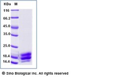 Sino Biological Cynomolgus IL17A Protein 1MG (Sino Biological), Quantity:
