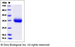Sino Biological Rat LAYN Protein 50ug (Sino Biological), Quantity: Each