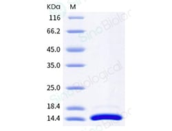 Sino Biological Human IL4 Protein 20ug (Sino Biological), Quantity: Each
