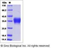 Sino Biological Recombinant Rat FOLR1 Protein (His Tag), HPLC-verified,