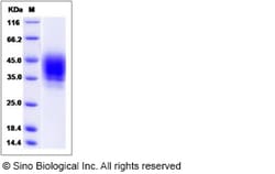 Sino Biological Rat CD48 Protein 100ug (Sino Biological), Quantity: Each