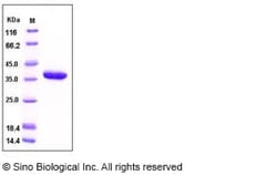Sino Biological Human CA10 Protein 1MG (Sino Biological), Quantity: Each