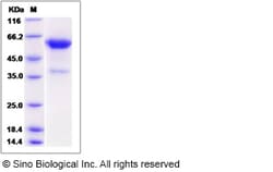 Sino Biological Rat COL4A3 Protein 100ug (Sino Biological), Quantity: Each