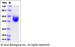 Sino Biological Rat ART4 Protein 100ug (Sino Biological), Quantity: Each