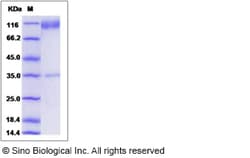 Sino Biological Rat CD34 Protein 50ug (Sino Biological), Quantity: Each