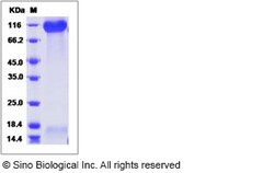 Sino Biological Recombinant Rhesus P-Selectin/CD62P Protein (His Tag),
