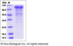Sino Biological Rat CDH6 Protein 200ug (Sino Biological), Quantity: Each