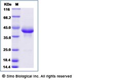 Sino Biological Recombinant Cynomolgus, Rhesus BCMA Protein (AVI & Fc Tag),