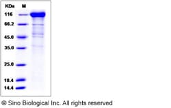 Sino Biological Rhesus IL6ST Protein 200ug (Sino Biological), Quantity: