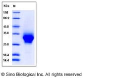 Sino Biological Rhesus FCGR2A Protein 100ug (Sino Biological), Quantity: