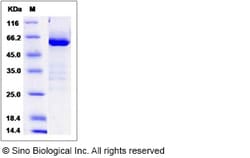 Sino Biological Rat NT5E Protein 50ug (Sino Biological), Quantity: Each