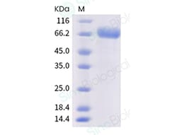 Sino Biological Human CD244 Protein 20ug (Sino Biological), Quantity: Each