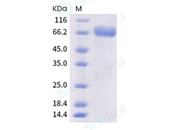 Sino Biological Human CD244 Protein 100ug (Sino Biological), Quantity:
