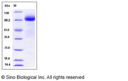 Sino Biological Recombinant Human ADAM15 Protein (His Tag), Quantity: Each