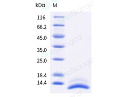 Sino Biological Human IL15 Protein 10ug (Sino Biological), Quantity: Each