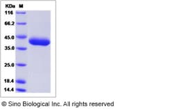 Sino Biological Cynomolgus ART1 Protein 100ug (Sino Biological), Quantity: