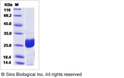 Sino Biological Human HPGDS Protein 50ug (Sino Biological), Quantity: Each