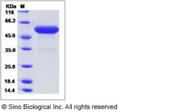 Sino Biological Sus scrofa (Pig) LGMN Protein 50ug (Sino Biological), Quantity: