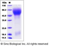 Sino Biological Rat PROM1 Protein 100ug (Sino Biological), Quantity: Each