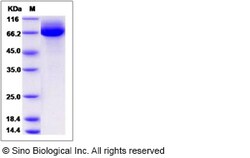 Sino Biological Rat CD36 Protein 100ug (Sino Biological), Quantity: Each