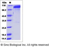 Sino Biological Rhesus EGFR Protein 50ug (Sino Biological), Quantity: Each