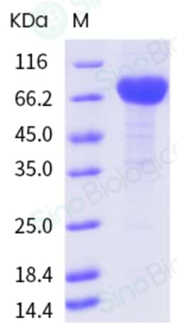 Sino Biological IL21R Protein 100ug (Sino Biological), Quantity: Each of