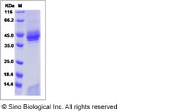 Sino Biological Rhesus CD1A & B2M Protein 100ug (Sino Biological), Quantity: