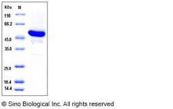 Sino Biological Human GBA3 Protein 50ug (Sino Biological), Quantity: Each