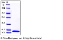 Sino Biological Human PMP2 Protein 1MG (Sino Biological), Quantity: Each