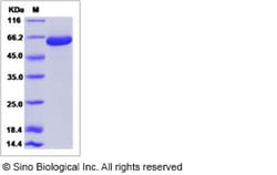 Sino Biological Recombinant Rat EphB3 Protein (ECD, His Tag), Quantity: