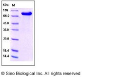 Sino Biological Human IL1RAPL2 Protein 1MG (Sino Biological), Quantity: