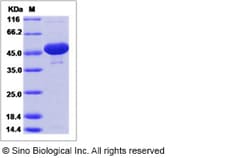 Sino Biological Rat ENO1 Protein 100ug (Sino Biological), Quantity: Each