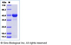 Rat CKMT2 Protein 50ug (Sino Biological)