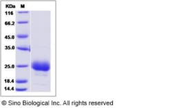 Rhesus CD160 Protein 100ug (Sino Biological)