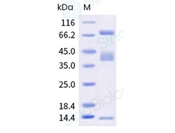 Human TGFB1 & GARP Protein 1MG (Sino Biological)