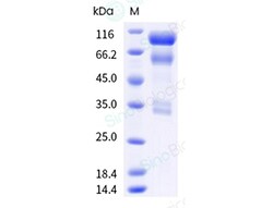 Sino Biological Human HGF Protein, Quantity: Each of 1