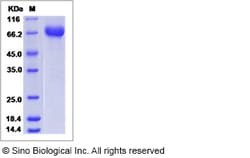 Sino Biological Recombinant Rat C1 inhibitor/C1-INH Protein (His Tag),