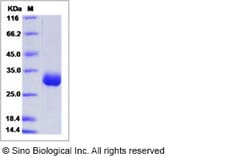 Sino Biological Mouse ANGPT1 Protein 1MG (Sino Biological), Quantity: Each