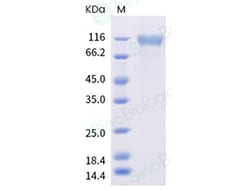 Sino Biological Human TNFRSF8 Protein 20ug (Sino Biological), Quantity: