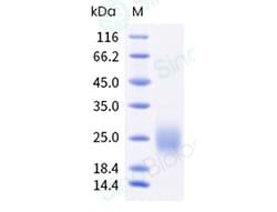Sino Biological Human CSF2 Protein 1MG (Sino Biological), Quantity: Each