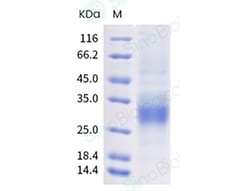 Sino Biological Human KLRC2 Protein 100ug (Sino Biological), Quantity: